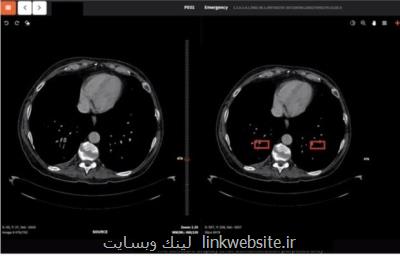 اقدامات مبتنی بر هوش مصنوعی محققان كشور برای مقابله با كرونا