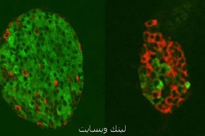 روش جدید احیای سلولی برای درمان دیابت